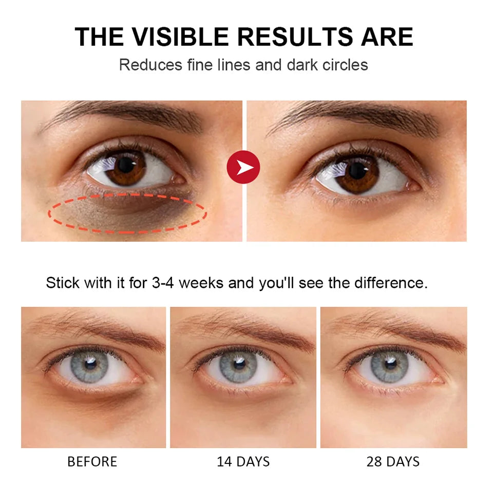 Retinol Eye Cream for Dark Circles and Firming - Smarsty