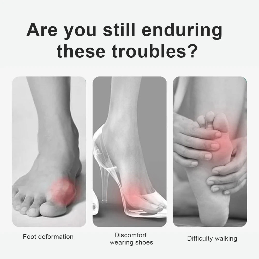 Toe Corrector Orthotics for Hallux Valgus Relief - Smarsty