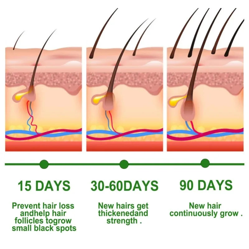 Rosemary Essential Oil for Moisturizing Healthy Hair - Smarsty