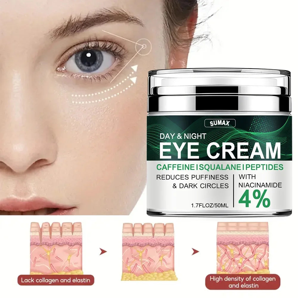 Nicotinamide Eye Cream for Dark Circles and Puffiness - Smarsty
