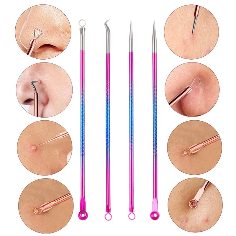4PCS Acne Blackhead Remover Tool Set for Clear Skin - Smarsty
