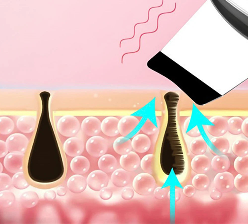 Ultrasonic Skin Scrubber for Deep Cleansing and Rejuvenation - Smarsty