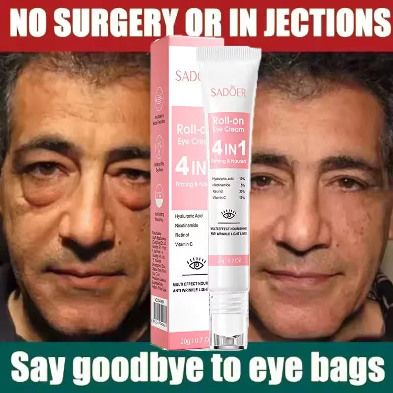 Instant Eye Bag Removal Cream for Dark Circles - Smarsty