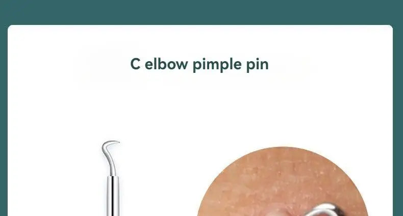 4 Piece Acne Blackhead Removal Needle Set - Smarsty