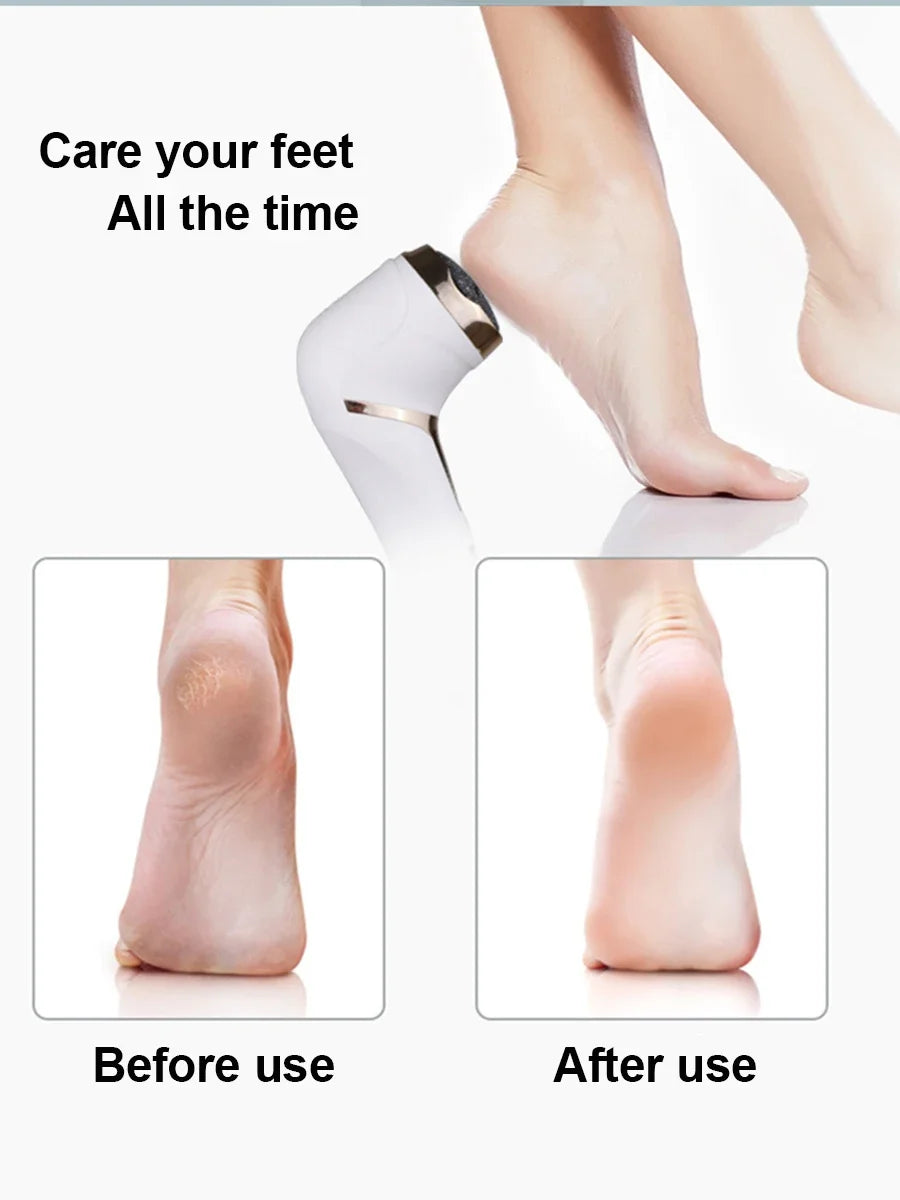 Rechargeable Electric Foot File Callus Remover for Smooth Feet - Smarsty