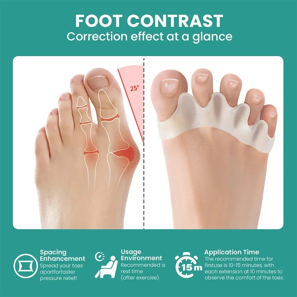 Silicone Toe Separators for Bunion Correction and Foot Comfort - Smarsty
