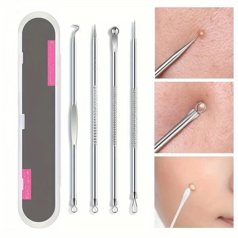 4 Piece Acne Blackhead Removal Needle Set - Smarsty