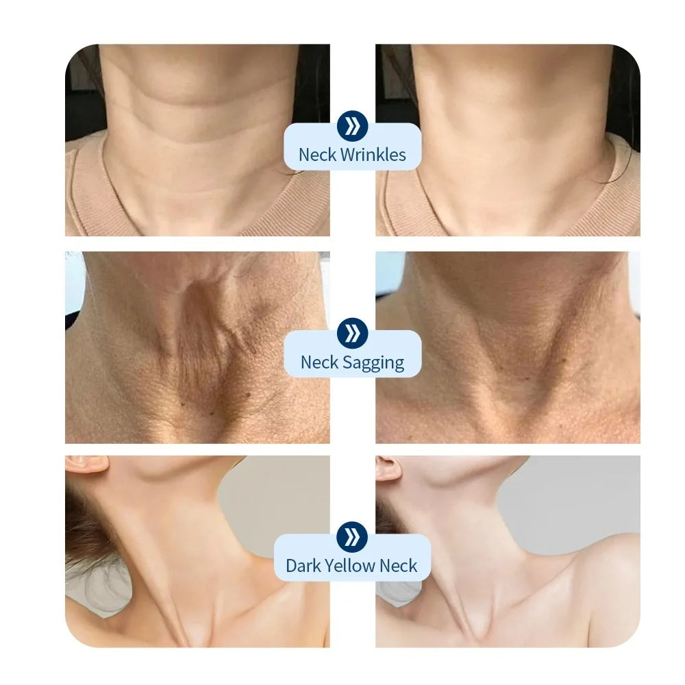 Neck LED Lift Mask for Skin Tightening and Rejuvenation - Smarsty