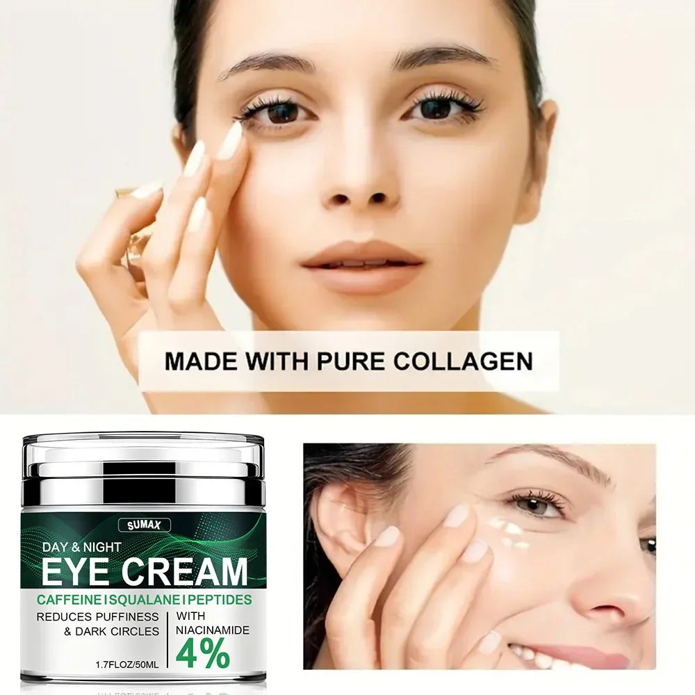 Nicotinamide Eye Cream for Dark Circles and Puffiness - Smarsty