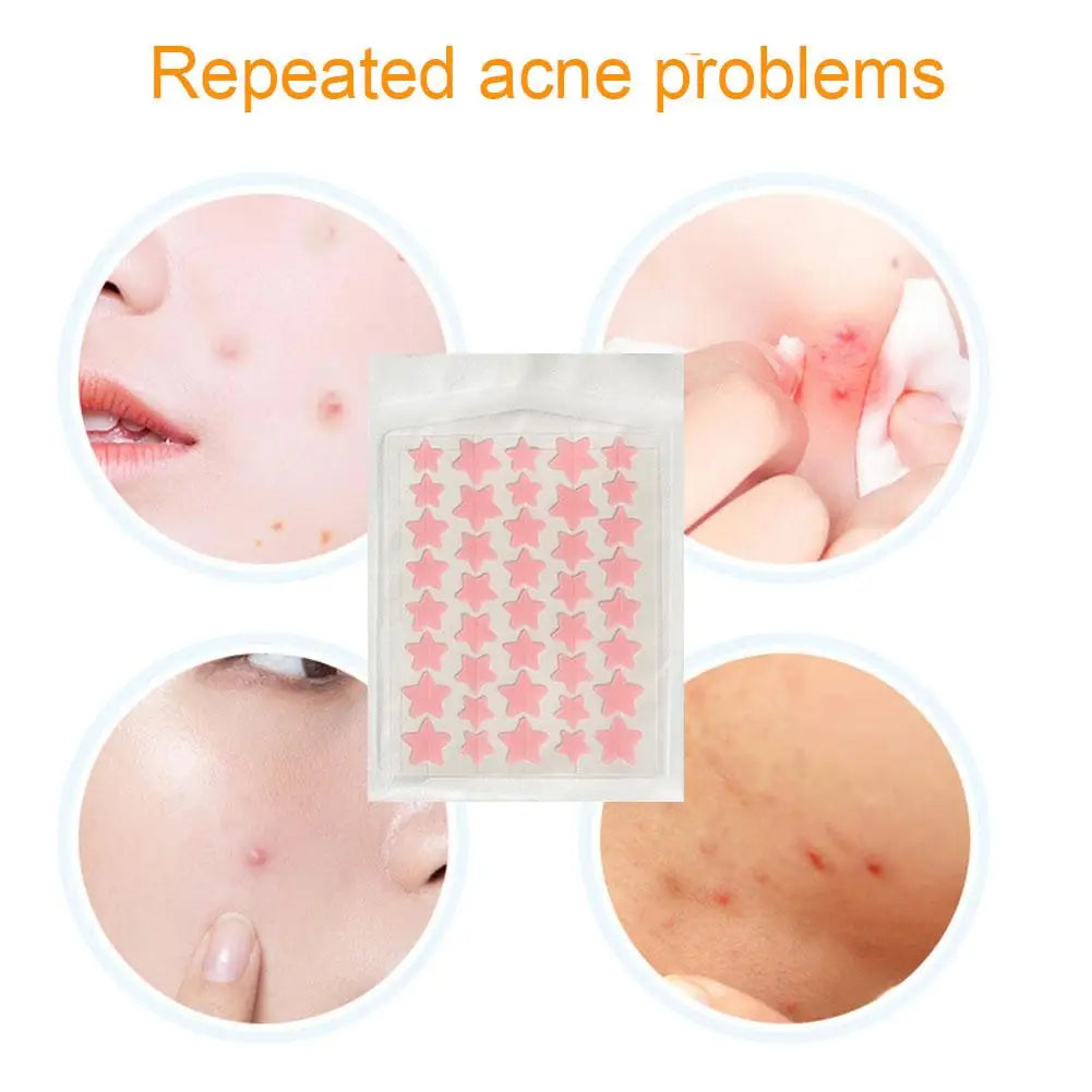 Colorful Star Heart Shaped Acne Pimple Patches - Smarsty