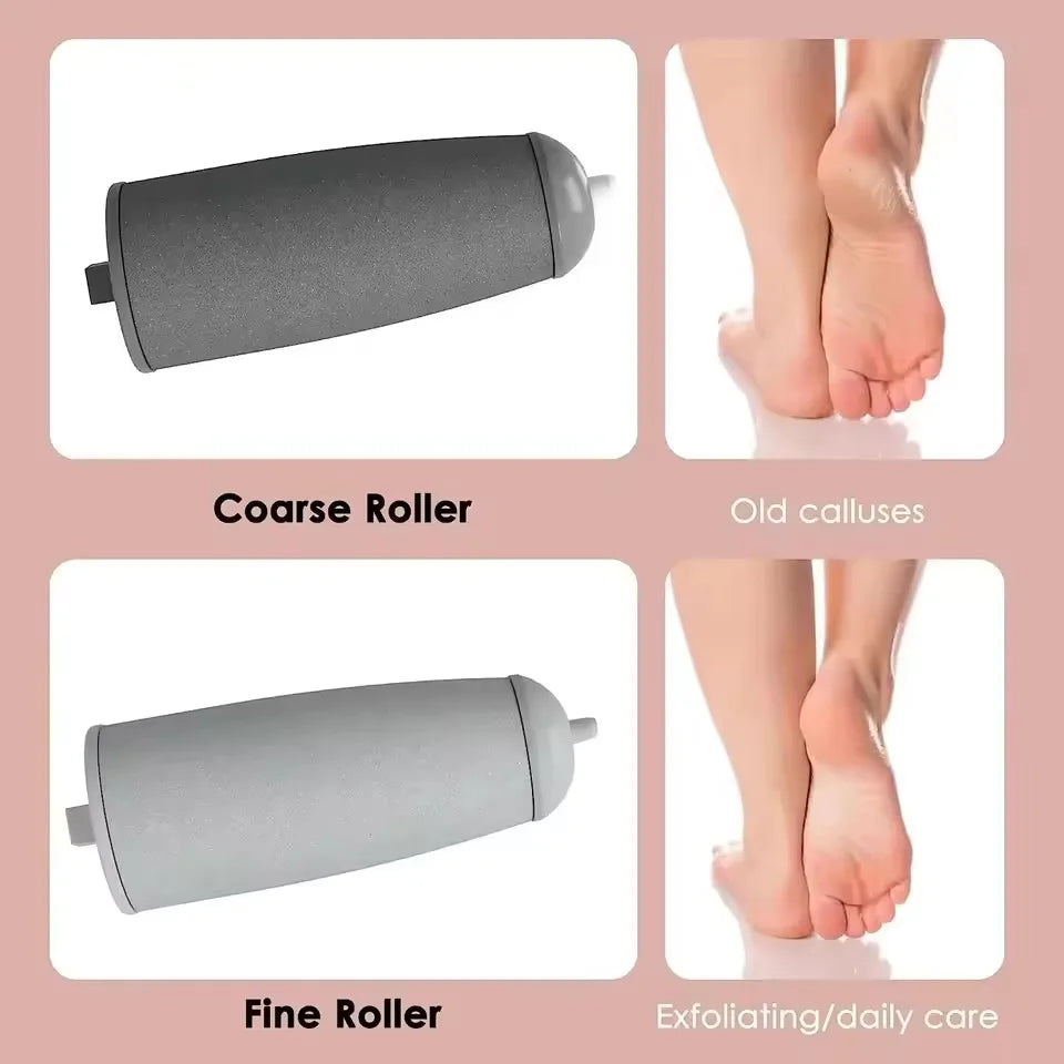 Rechargeable Electric Foot Callus Remover for Smooth Skin - Smarsty