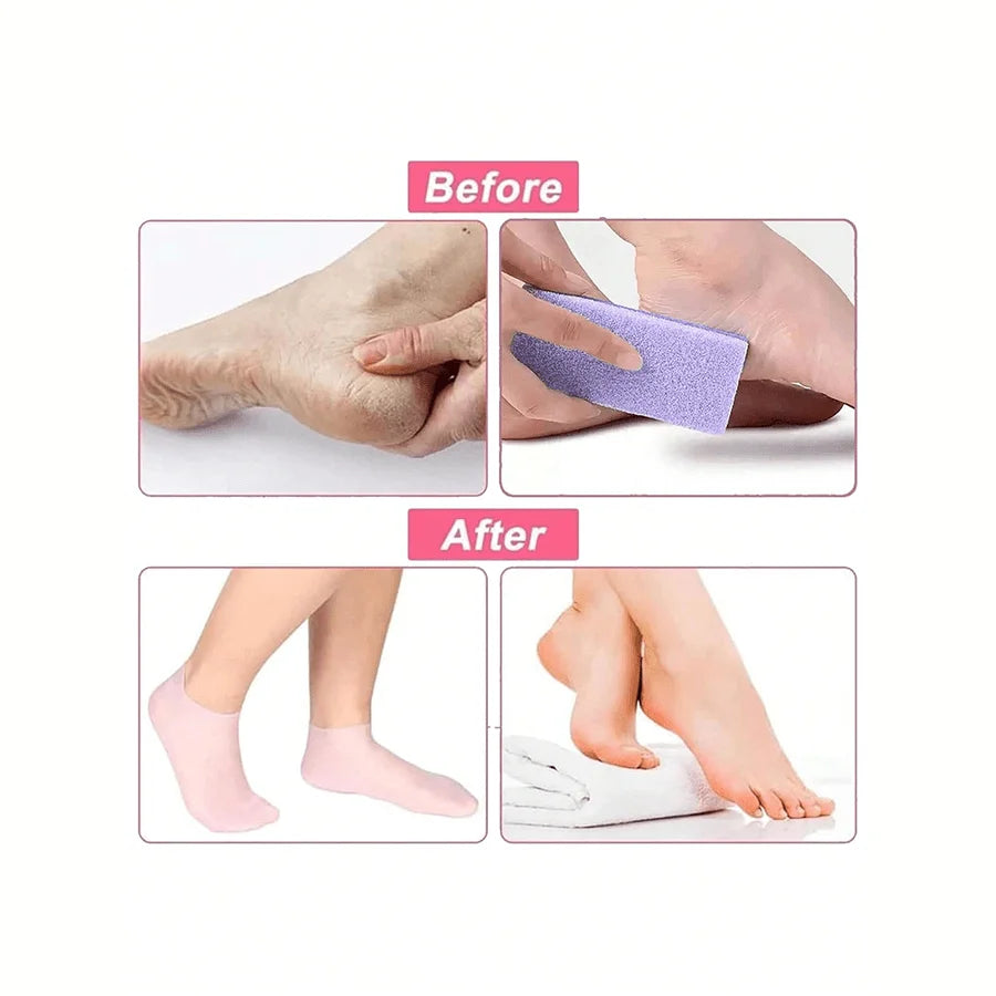 Moisturizing Silicone Foot Socks for Cracked Feet - Smarsty