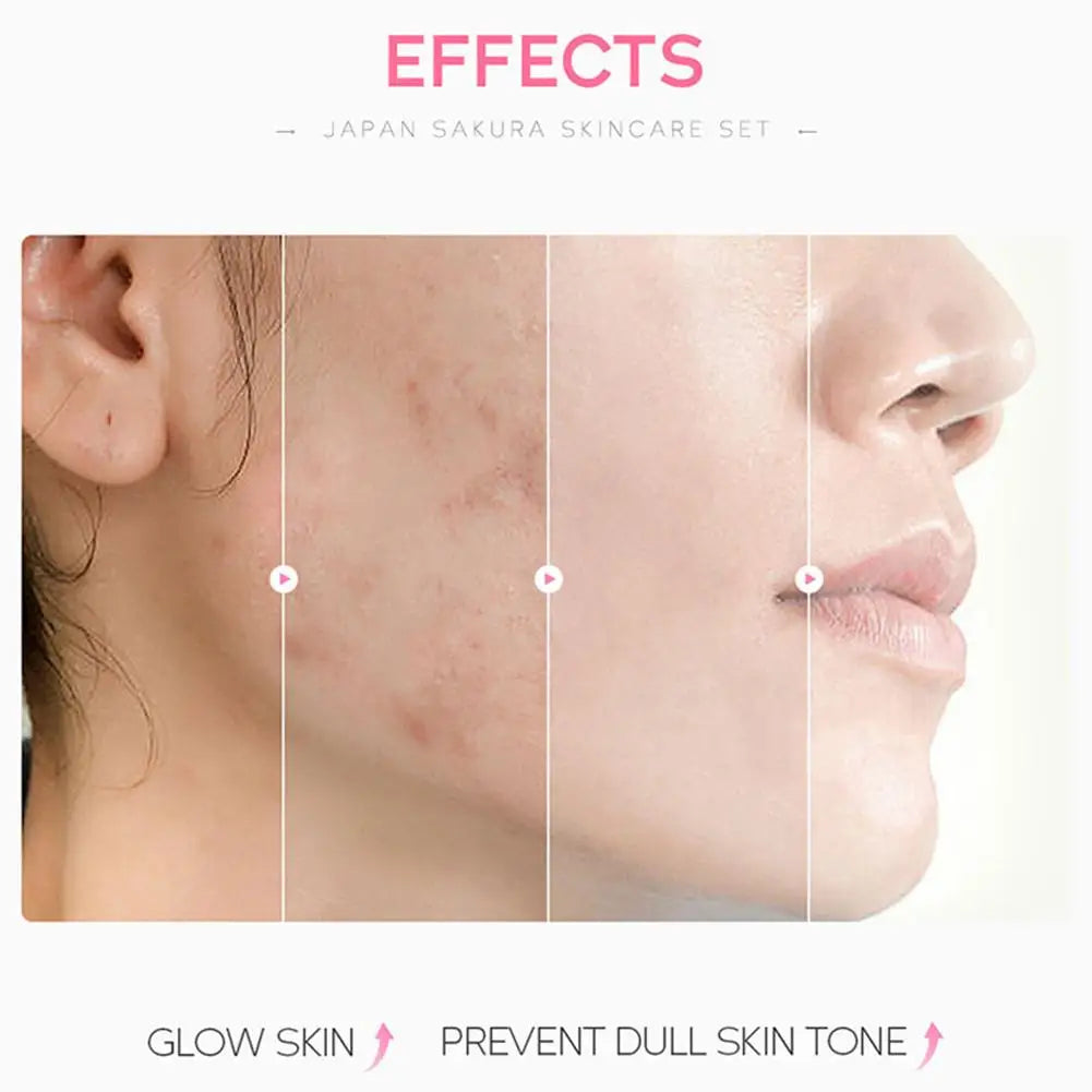 5/3pcs/Set Sakura Skin Care Sets Face Cream Serum Toner Facial Cleanser Sunscreen Eye Cream Gift Box Face Skin Care Set Product - Smarsty