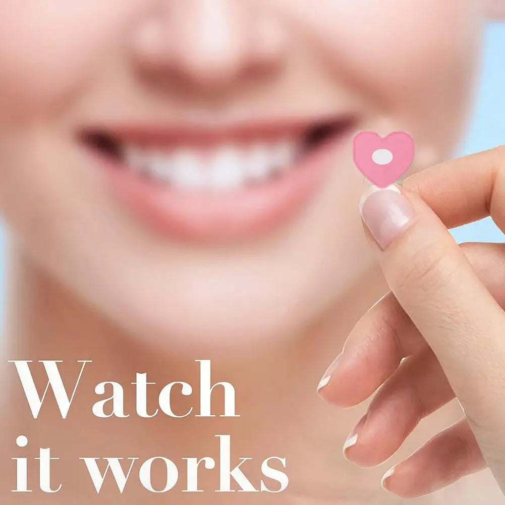 360 Pcs Colorful Hydrocolloid Acne Patches for Quick Healing - Smarsty