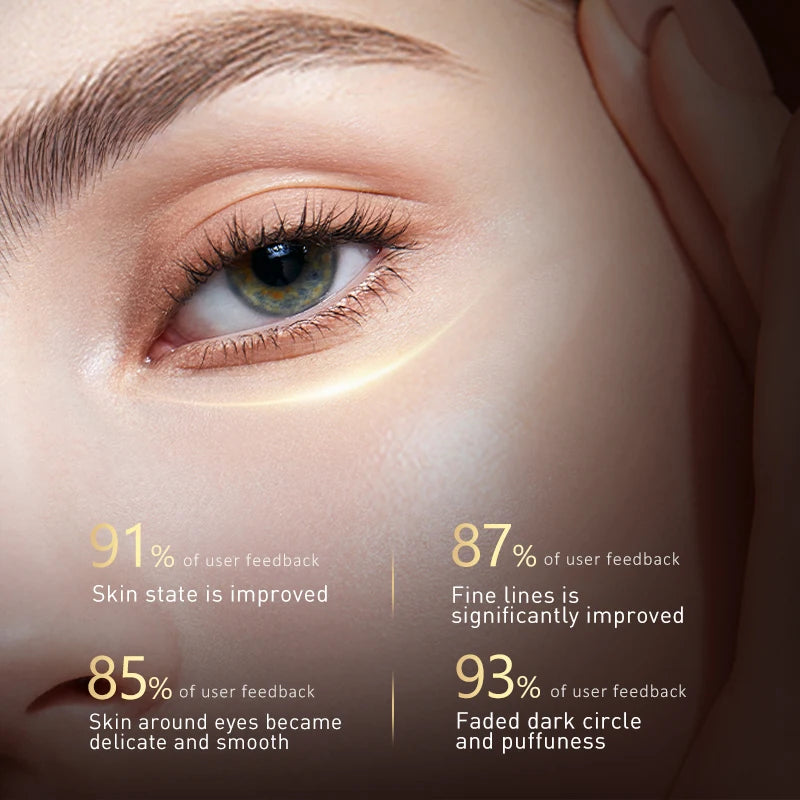 O'CHEAL Eye Moisturizing Cream for Dark Circles and Puffiness - Smarsty