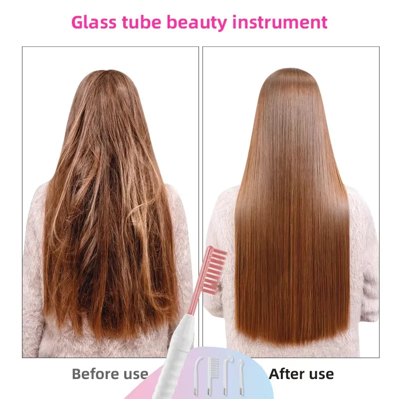 4 in 1 High Frequency Acne Treatment Wand - Smarsty