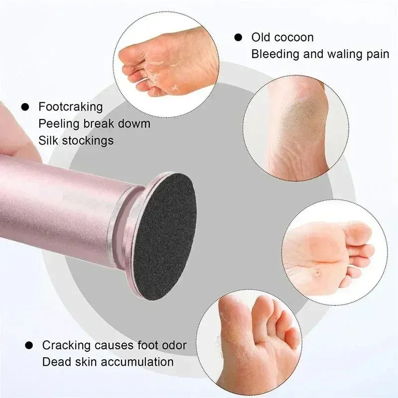 Electric Foot Scrub For Efficient Dead Skin Removal - Smarsty