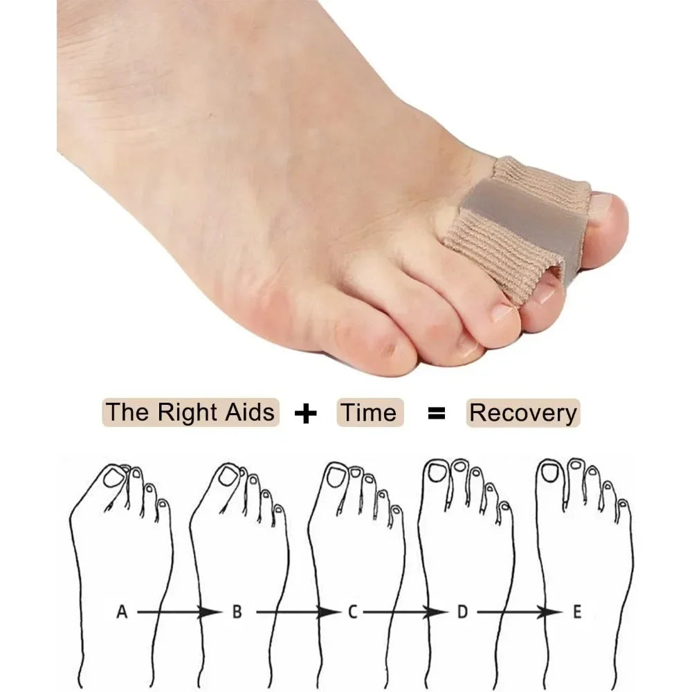 Two Toe Separator Bunion Corrector for Foot Care - Smarsty