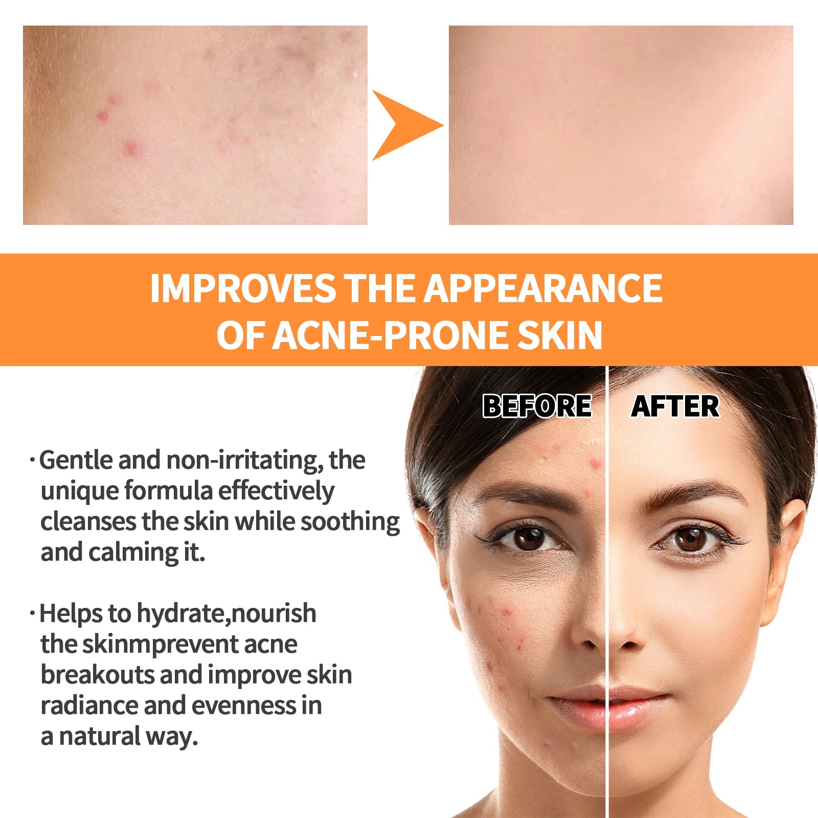 EELHOE Turmeric Skin Care Original Face Cream Serum Oil Stick Mask Body Whitening Anti Acne Lighten Dark Spot Moisturizing