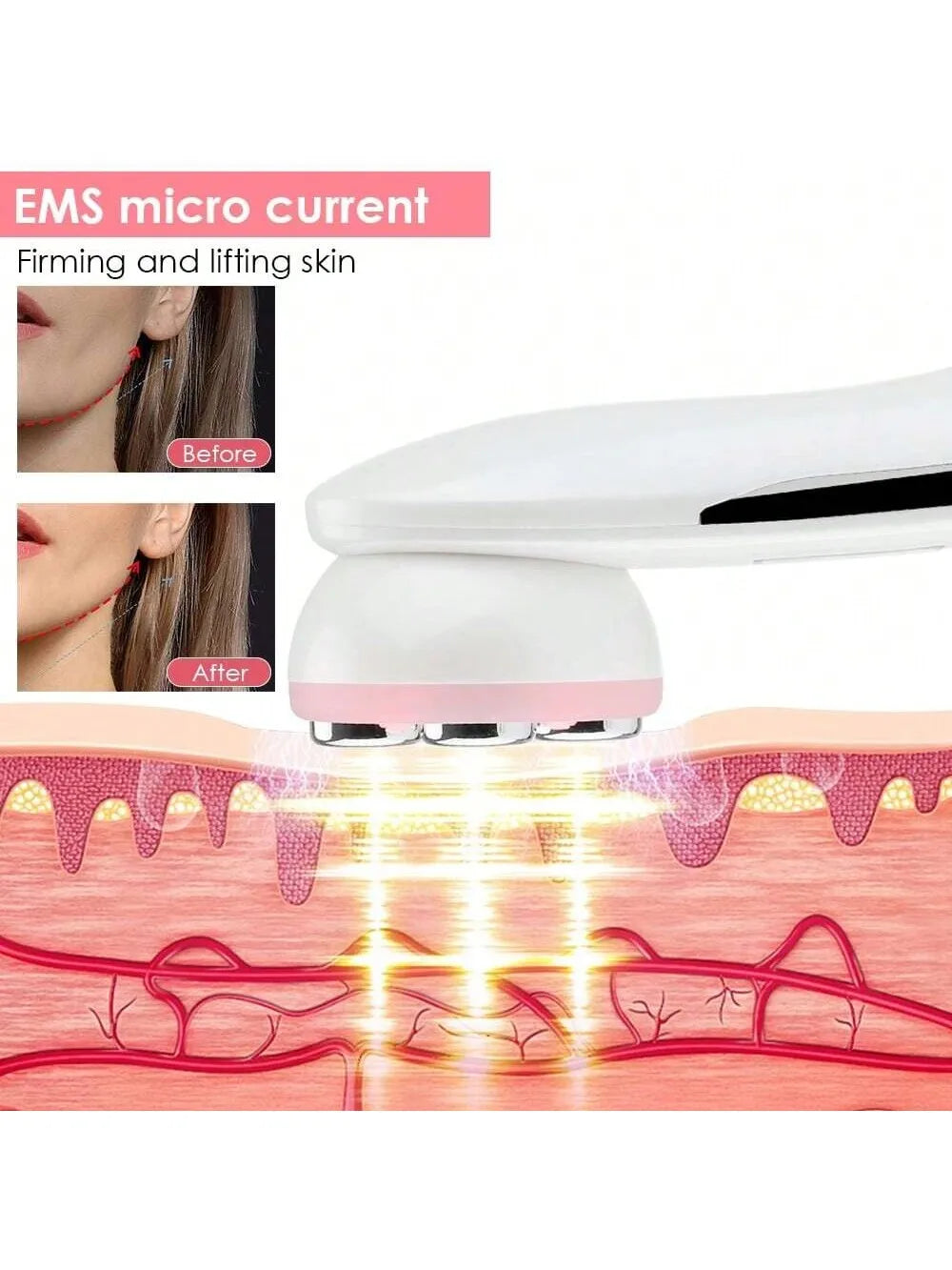 Professional Ultrasonic Face Exfoliator Skin Cleaner Tool - Smarsty