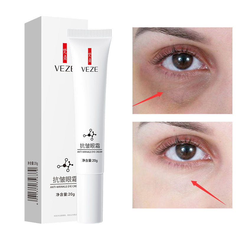 Nicotinamide Eye Cream for Dark Circles and Puffiness - Smarsty