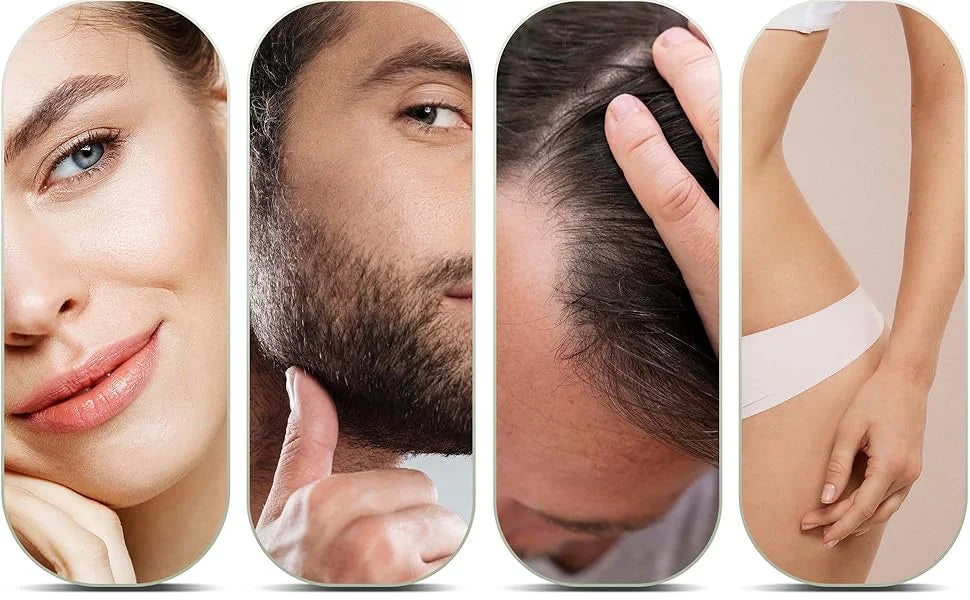 Derma Roller With 540 Needles For Hair Growth - Smarsty