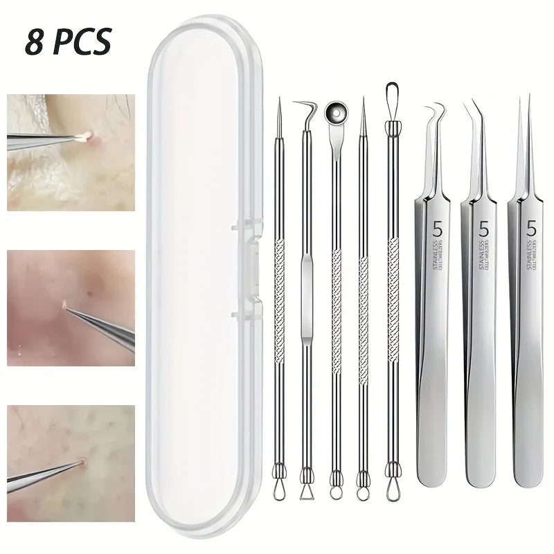 Stainless Steel Blackhead Remover Kit for Clear Skin - Smarsty