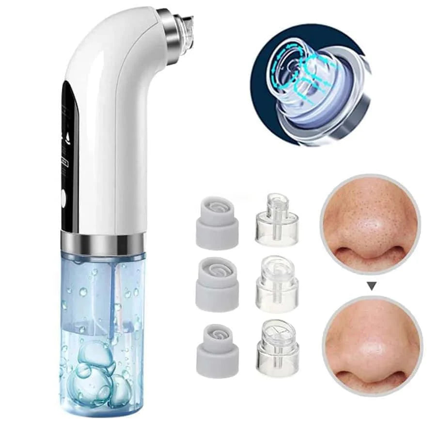 USB Rechargeable Pore Vacuum Blackhead Remover Tool - Smarsty