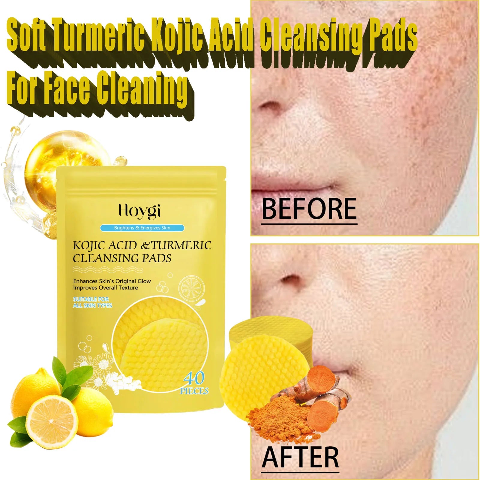 Turmeric Kojic Acid Cleansing Pads for Radiant Skin - Smarsty