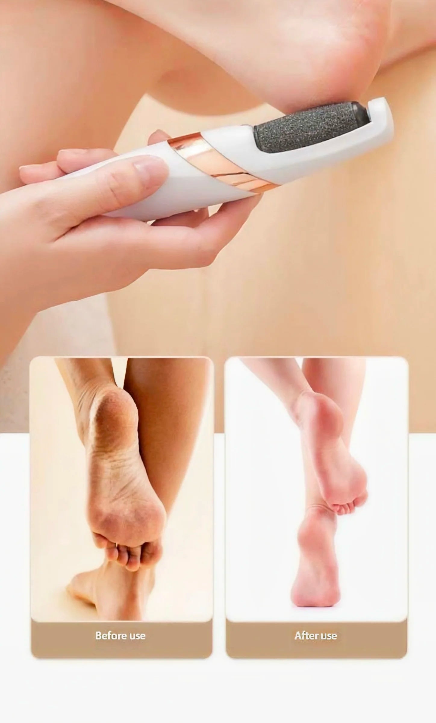 Rechargeable Electric Foot Callus Remover for Smooth Skin - Smarsty