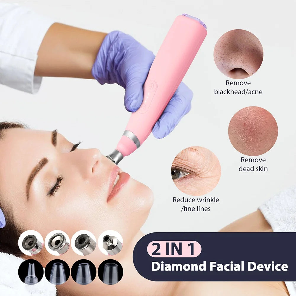 Professional Diamond Microdermabrasion Machine for Home Use - Smarsty