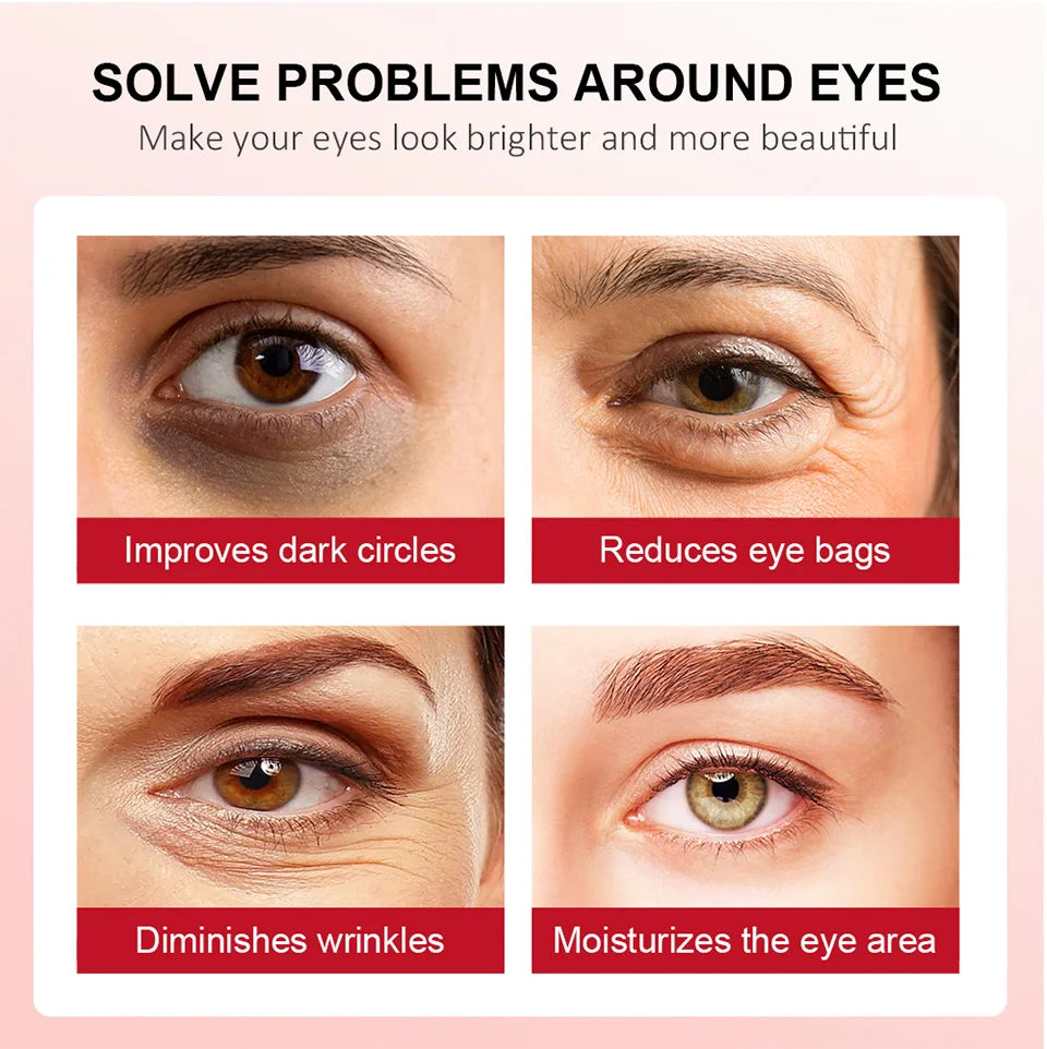 Retinol Eye Cream for Dark Circles and Firming - Smarsty