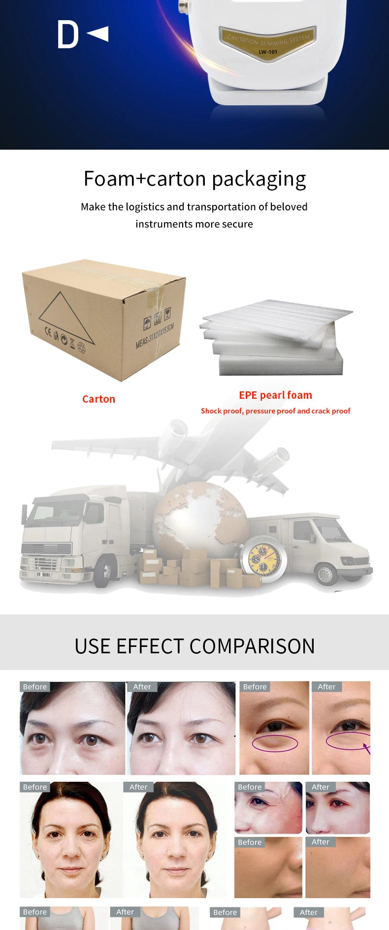 Ultrasonic Cavitation Weight Loss Machine for Body Shaping - Smarsty