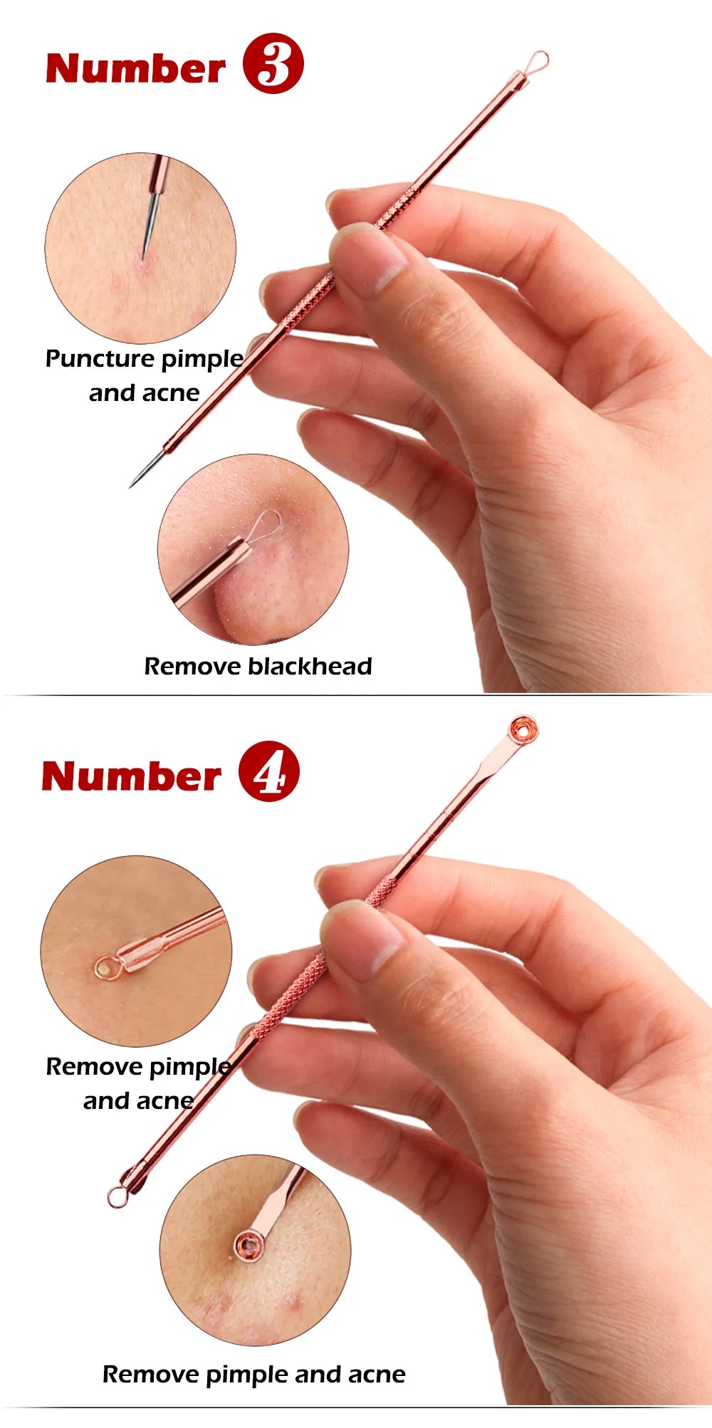 4PCS Acne Blackhead Remover Tool Set for Clear Skin - Smarsty