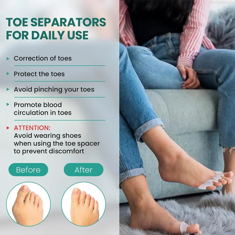 Silicone Toe Separators for Bunion Correction and Foot Comfort - Smarsty