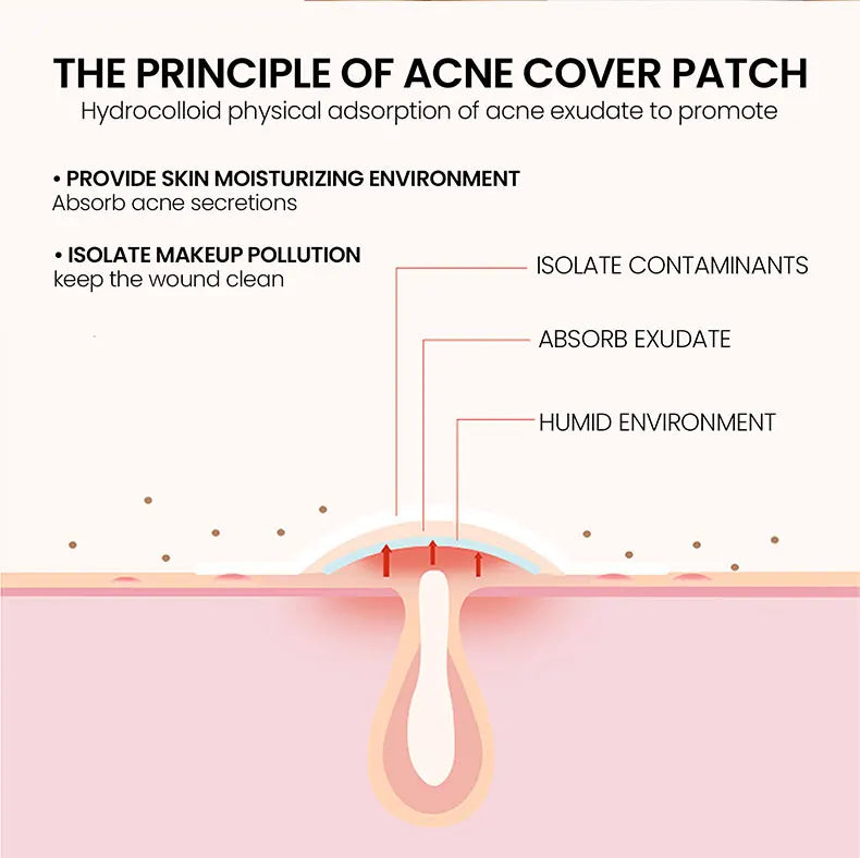 Effective Acne Repair Patch for Fading Blemishes - Smarsty