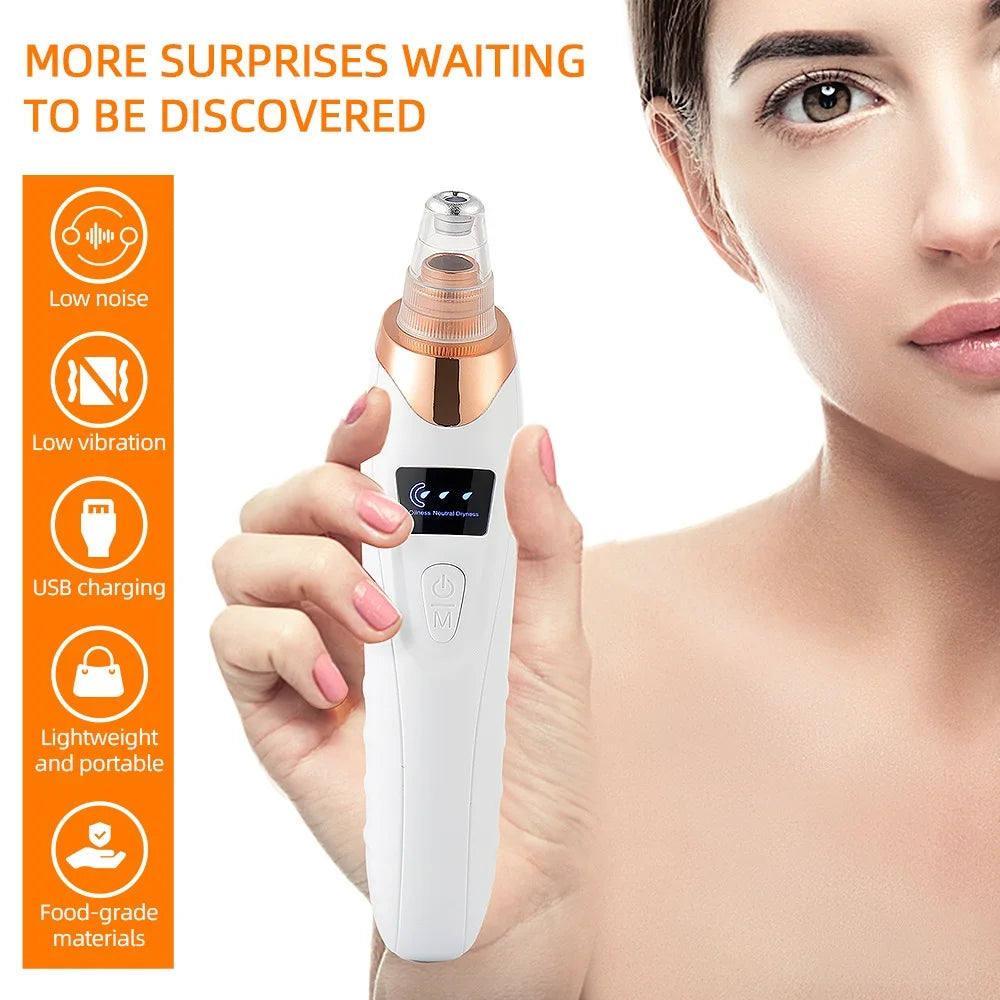 Vacuum Blackhead Remover With USB Charging Convenience - Smarsty