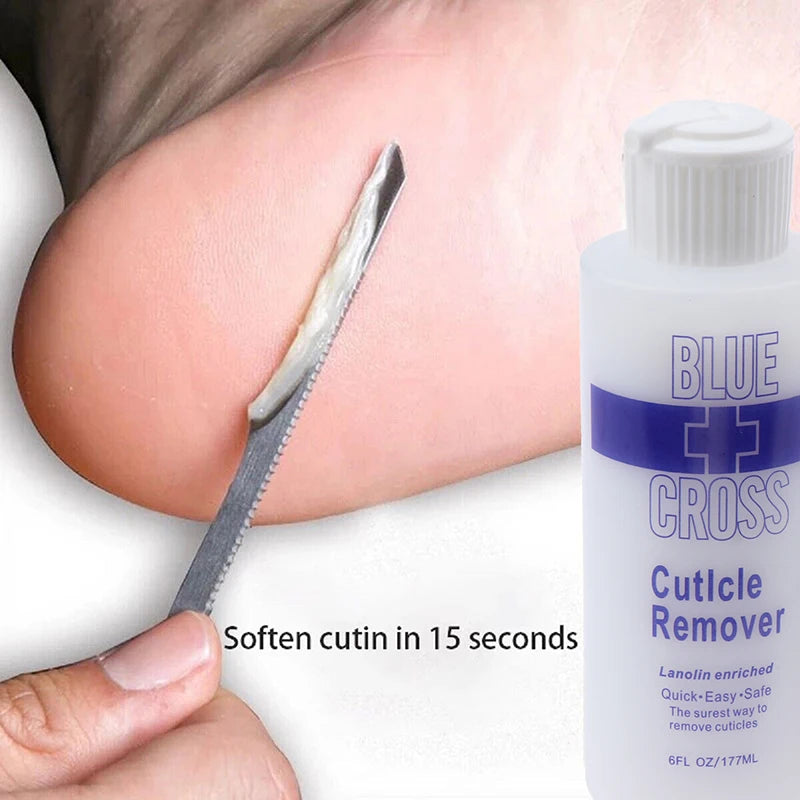 Foot Exfoliator and Callus Remover for Soft Skin - Smarsty