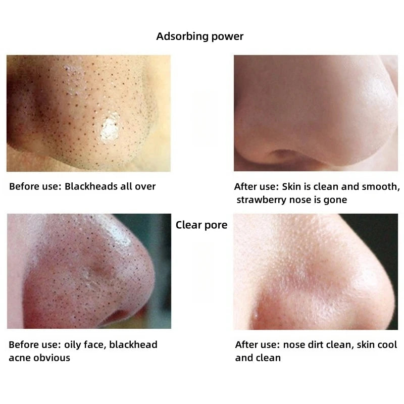 Blackhead Removal Mask for Deep Pore Cleansing - Smarsty