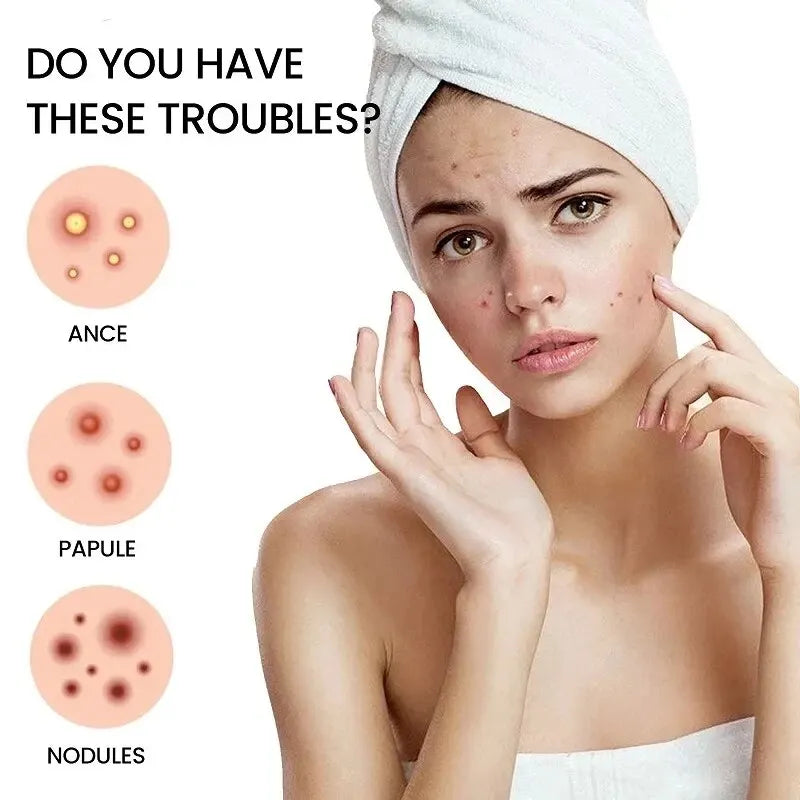 Effective Acne Repair Patch for Fading Blemishes - Smarsty