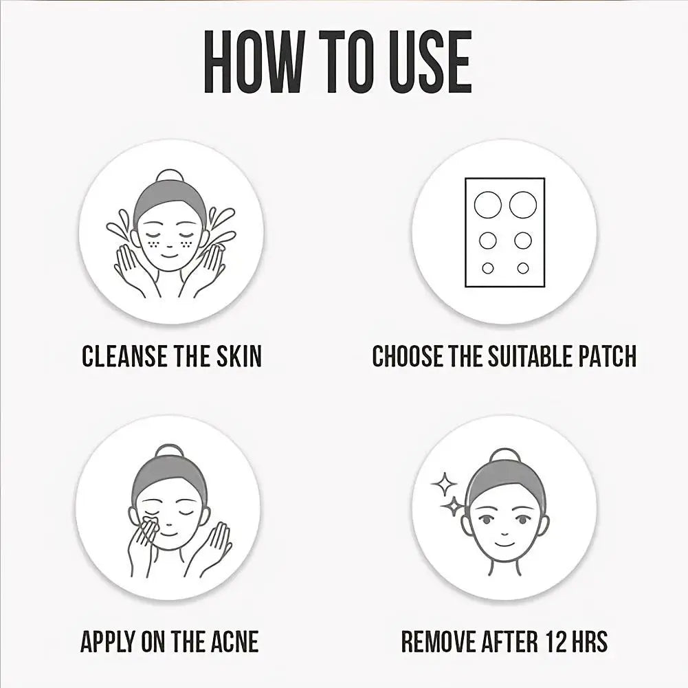 360 Pcs Colorful Hydrocolloid Acne Patches for Quick Healing - Smarsty