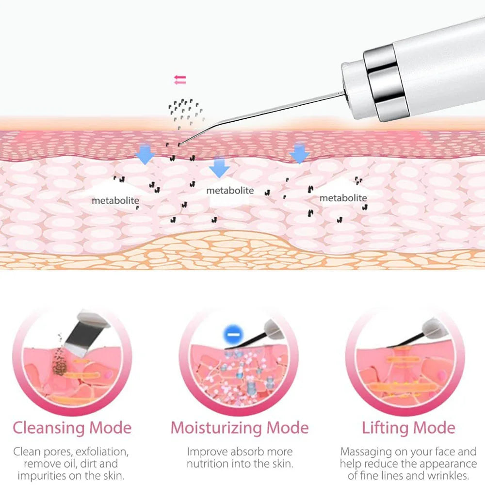 Ultrasonic Skin Scrubber for Deep Cleansing and Rejuvenation - Smarsty