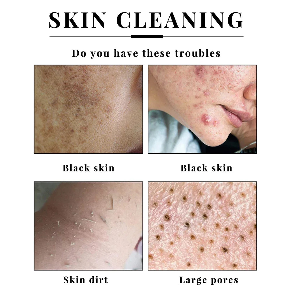 Handmade Kojic Acid Soap for Brightening Skin Exfoliation - Smarsty