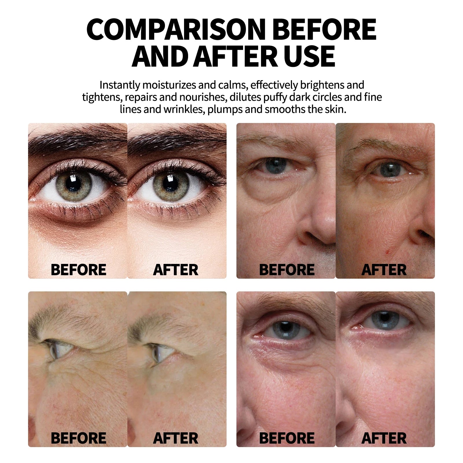 Men's Retinol Eye Cream for Dark Circles and Puffiness - Smarsty