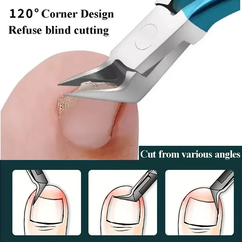 Stainless Steel Toe Nail Clippers for Ingrown Nails - Smarsty