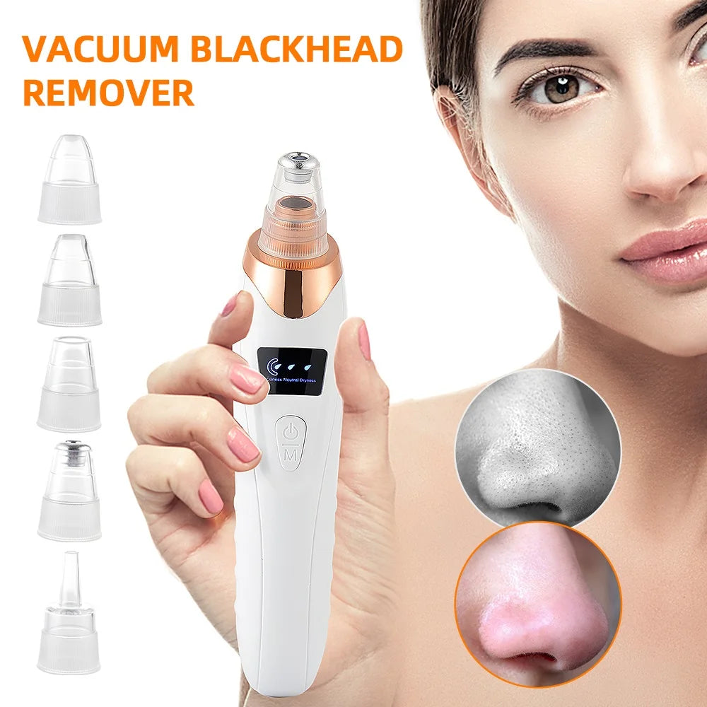 Vacuum Blackhead Remover With USB Charging Convenience - Smarsty