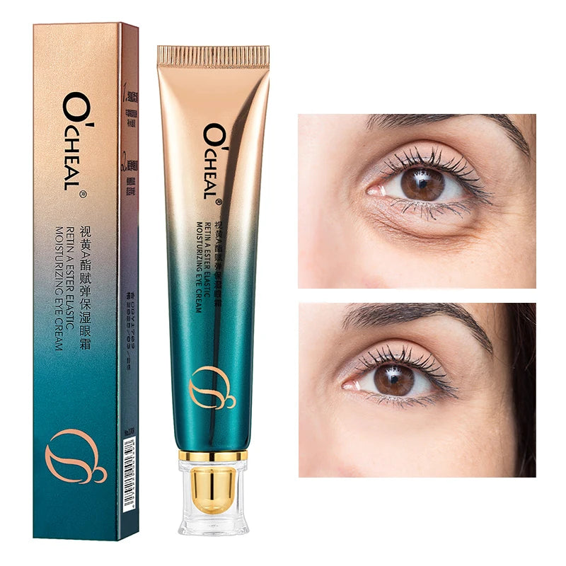 O'CHEAL Eye Moisturizing Cream for Dark Circles and Puffiness - Smarsty