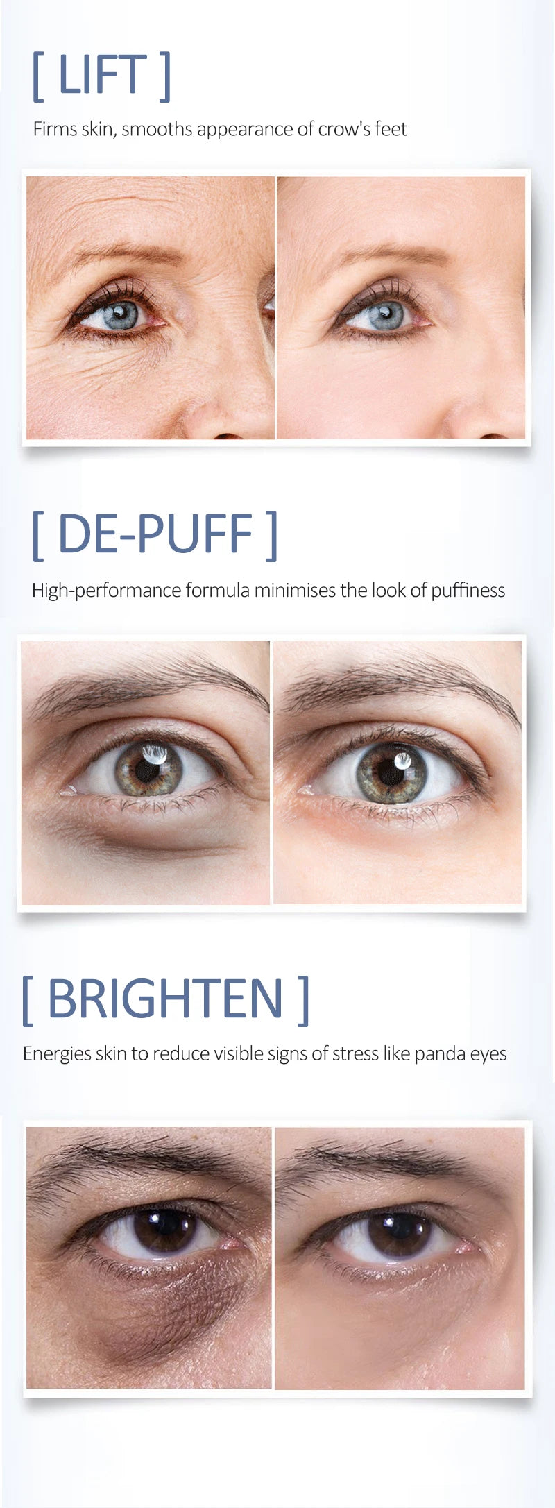 O'CHEAL Eye Moisturizing Cream for Dark Circles and Puffiness - Smarsty