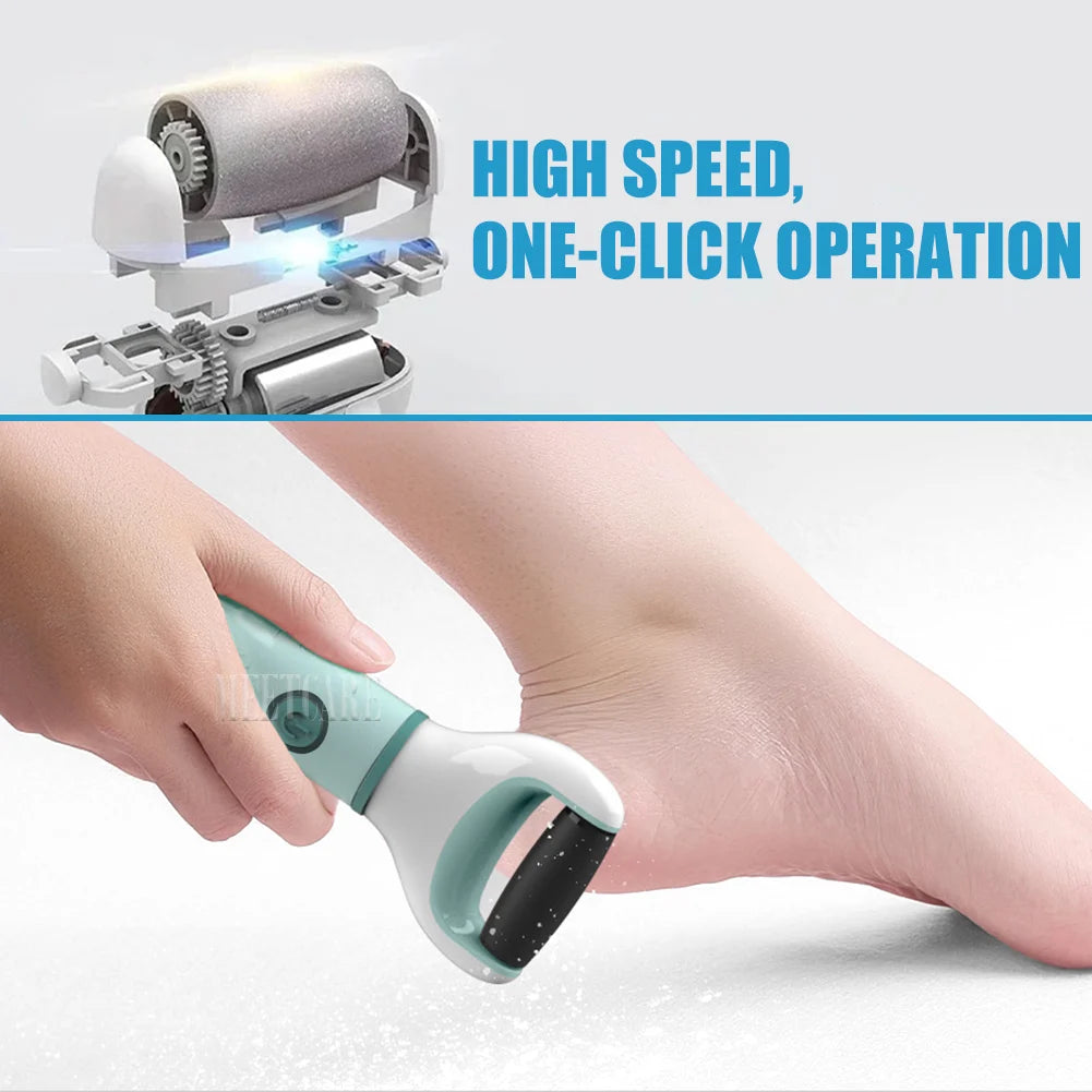 Electric Foot Grinder for Smooth Soft Skin - Smarsty