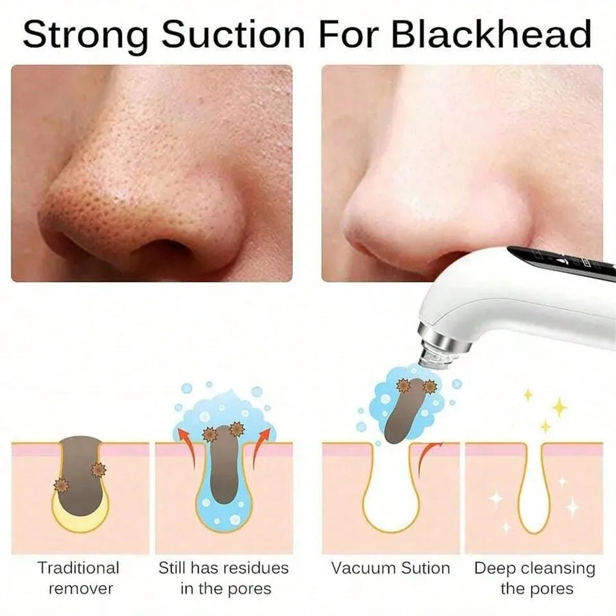 USB Rechargeable Pore Vacuum Blackhead Remover Tool - Smarsty